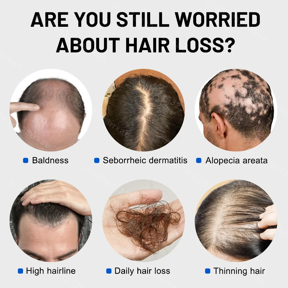 Hair growth products for men and women anti-hair loss rapid hair growth effective repair of baldness symptoms of hair loss