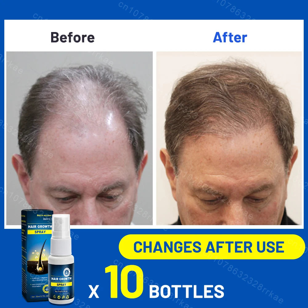 Hair growth products Fast Hair Growth Hair care Repair hair Anti-hair loss