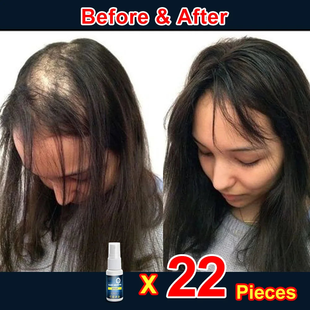 Hair growth products for men and women anti-hair loss rapid hair growth effective repair of baldness symptoms of hair loss