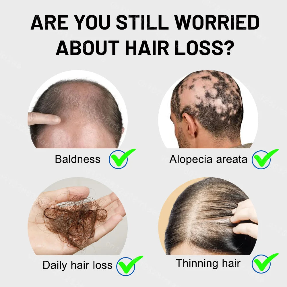 Hair growth products for men and women anti-hair loss rapid hair growth effective repair of baldness symptoms of hair loss