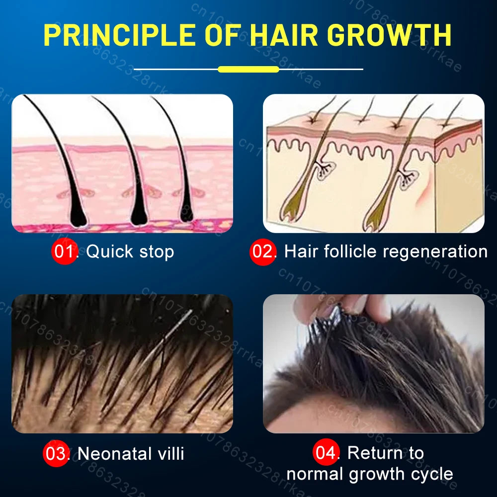 Hair growth products for men and women anti-hair loss rapid hair growth effective repair of baldness symptoms of hair loss