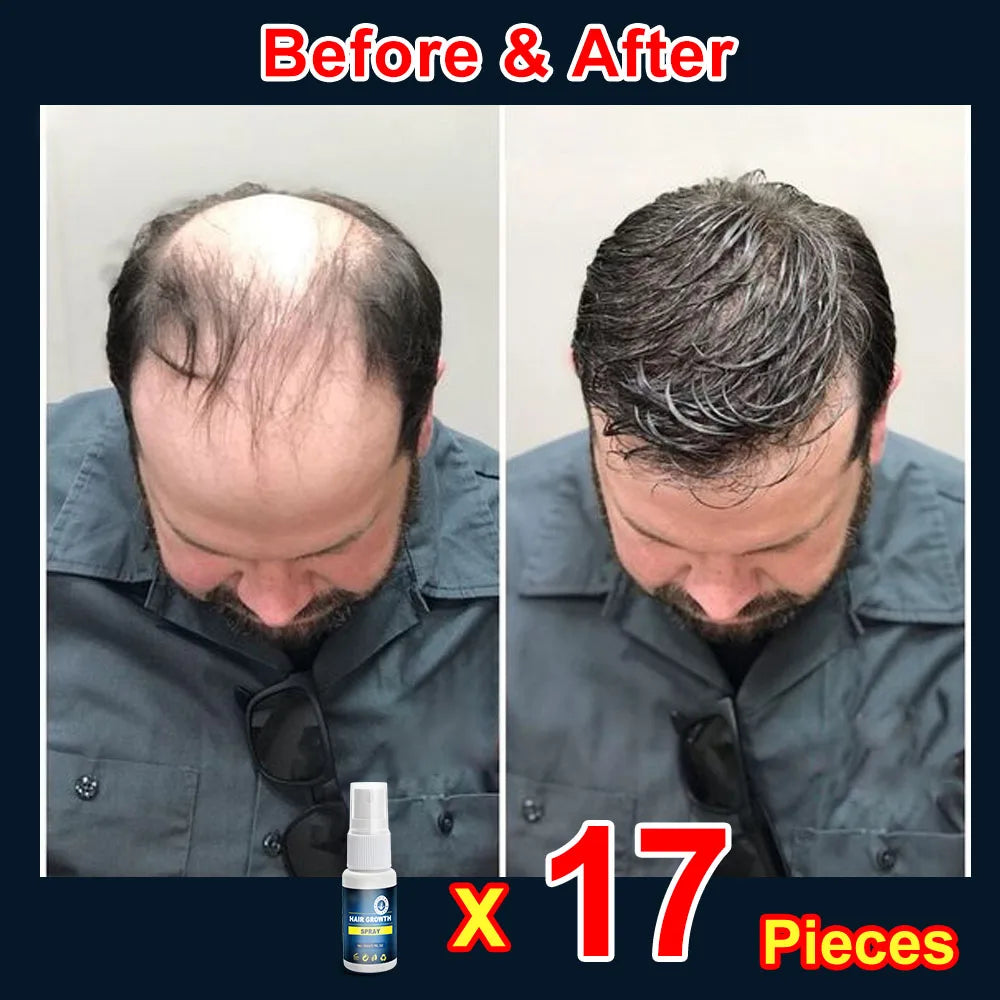 Hair growth products for men and women anti-hair loss rapid hair growth effective repair of baldness symptoms of hair loss