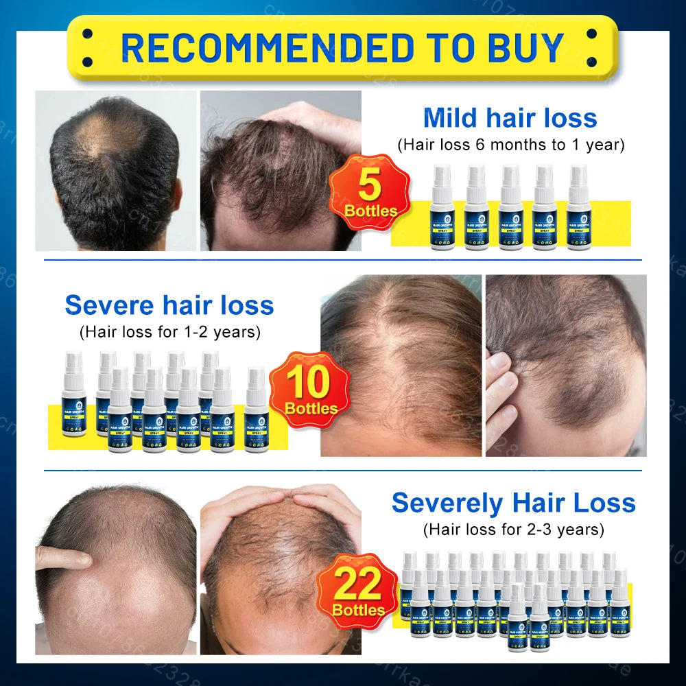 Hair growth products Fast Hair Growth Hair care Repair hair Anti-hair loss