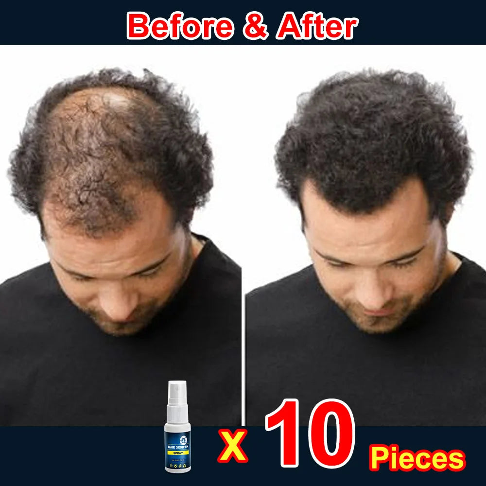 Hair growth products for men and women anti-hair loss rapid hair growth effective repair of baldness symptoms of hair loss