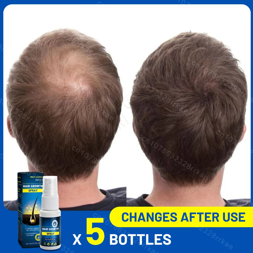 Hair growth products Fast Hair Growth Hair care Repair hair Anti-hair loss